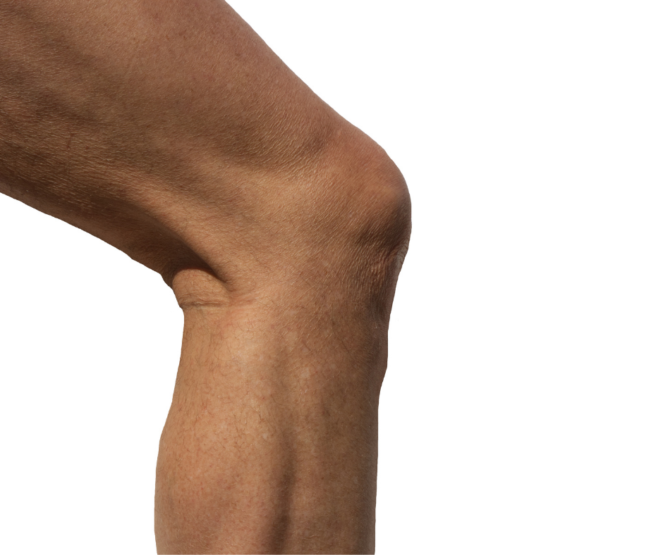 Knee pain treatment in paoli