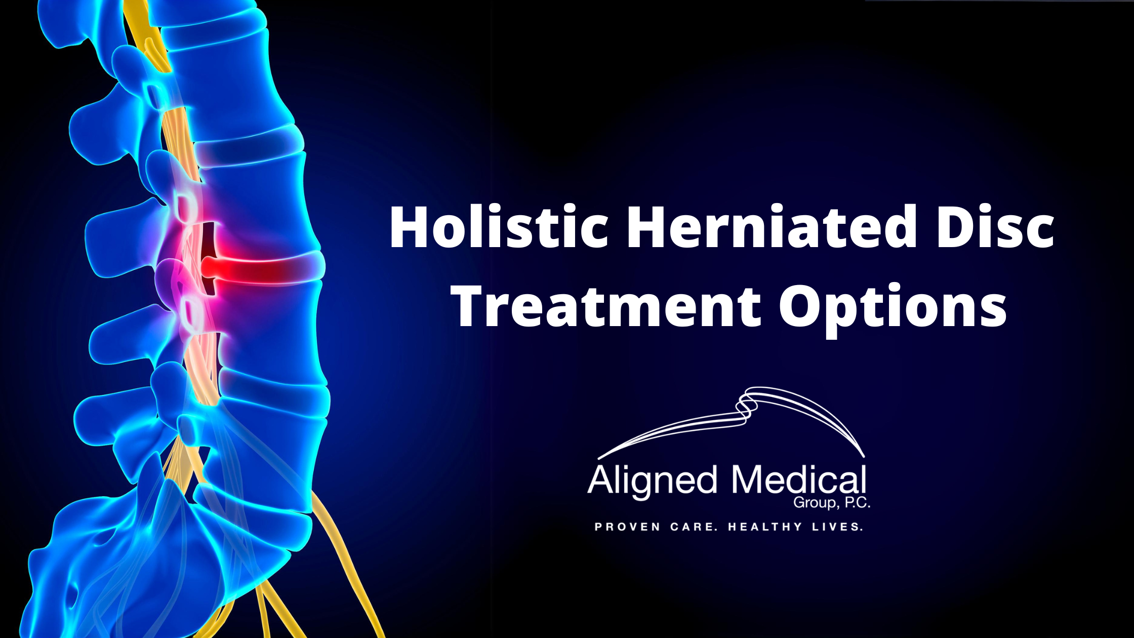 Holistic Herniated Disc Treatment Options