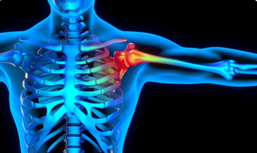 Shoulder Pain Treatment